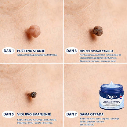 𝐏𝐢𝐜𝐝𝐨®🧑‍⚕️ 7-dnevna 𝐤𝐫𝐞𝐦𝐚 𝐳𝐚 𝐤𝐨ž𝐧𝐞 𝐢𝐳𝐫𝐚𝐬𝐭𝐚𝐣𝐞 & 𝐩𝐢𝐠𝐦𝐞𝐧𝐭𝐚𝐜𝐢𝐣𝐬𝐤𝐞 𝐦𝐫𝐥𝐣𝐞 (bezbolna formula – bez ožiljaka)