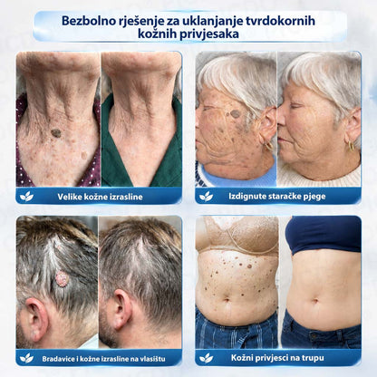 𝐏𝐢𝐜𝐝𝐨®🧑‍⚕️ 7-dnevna 𝐤𝐫𝐞𝐦𝐚 𝐳𝐚 𝐤𝐨ž𝐧𝐞 𝐢𝐳𝐫𝐚𝐬𝐭𝐚𝐣𝐞 & 𝐩𝐢𝐠𝐦𝐞𝐧𝐭𝐚𝐜𝐢𝐣𝐬𝐤𝐞 𝐦𝐫𝐥𝐣𝐞 (bezbolna formula – bez ožiljaka)