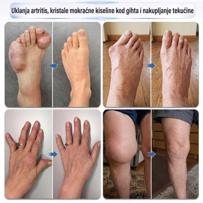 𝗜𝐅𝙈𝗔𝑮𝗜𝐂® 💠0,05 mm na kĺby a kosti – mikroihličkový valček 🎁