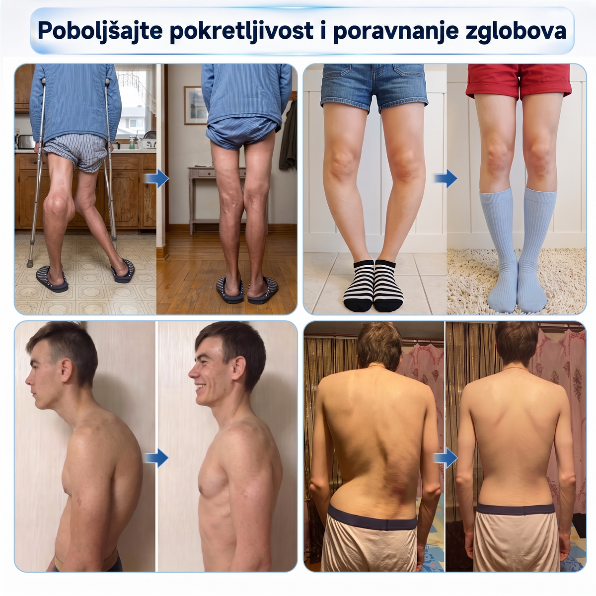 𝗜𝐅𝙈𝗔𝑮𝗜𝐂® 💠0,05 mm na kĺby a kosti – mikroihličkový valček 🎁