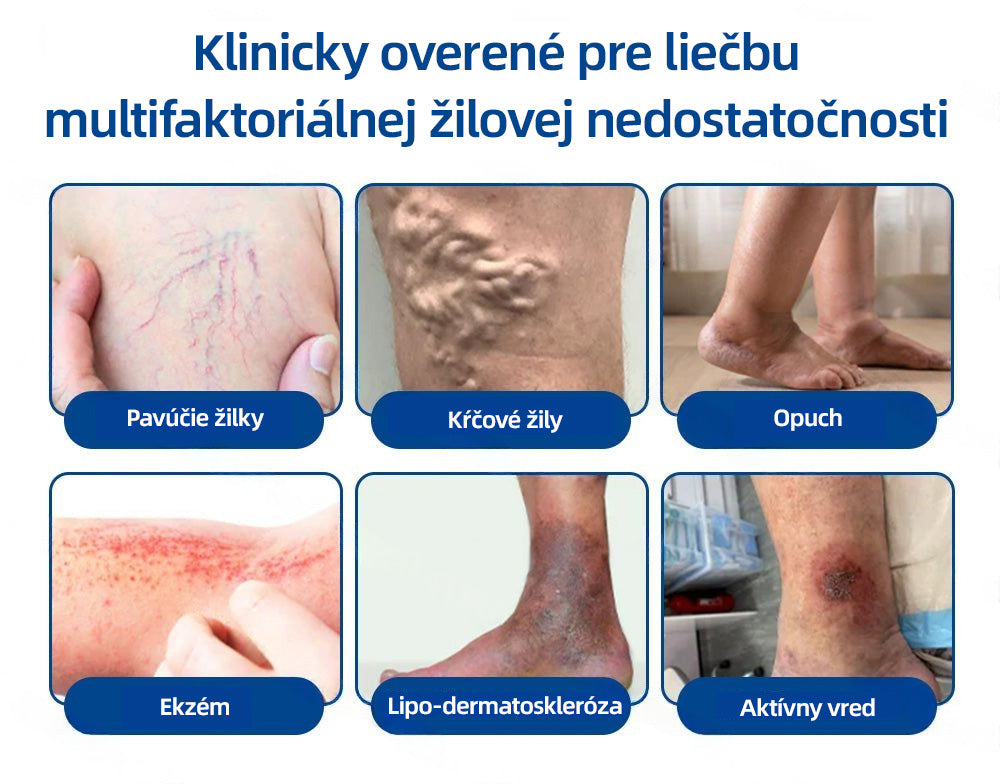Healrize® VeinTarget mikrojihlová náplasť | Okamžitá úľava, dlhodobé výsledky