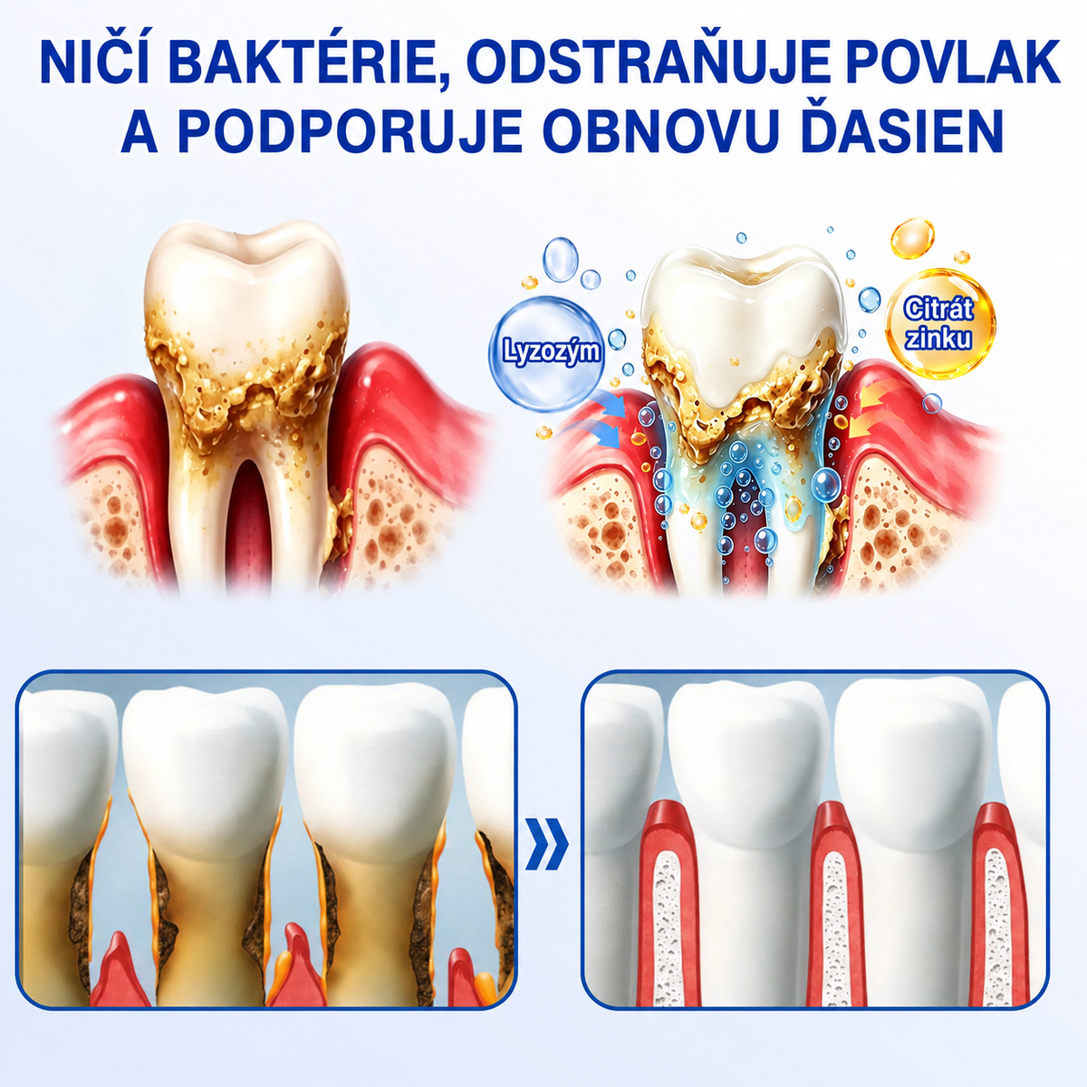 👨‍⚕️🦷 Evolvion® GumRevive – regeneračný gél na parodont🎁
