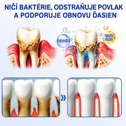 👨‍⚕️🦷 Evolvion® GumRevive – regeneračný gél na parodont🎁