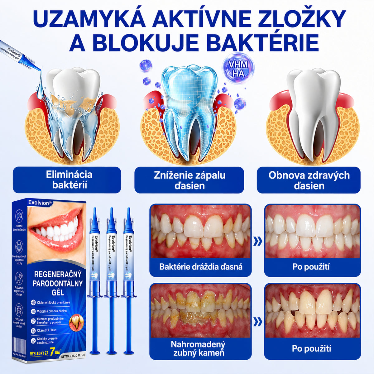 👨‍⚕️🦷 Evolvion® GumRevive – regeneračný gél na parodont🎁