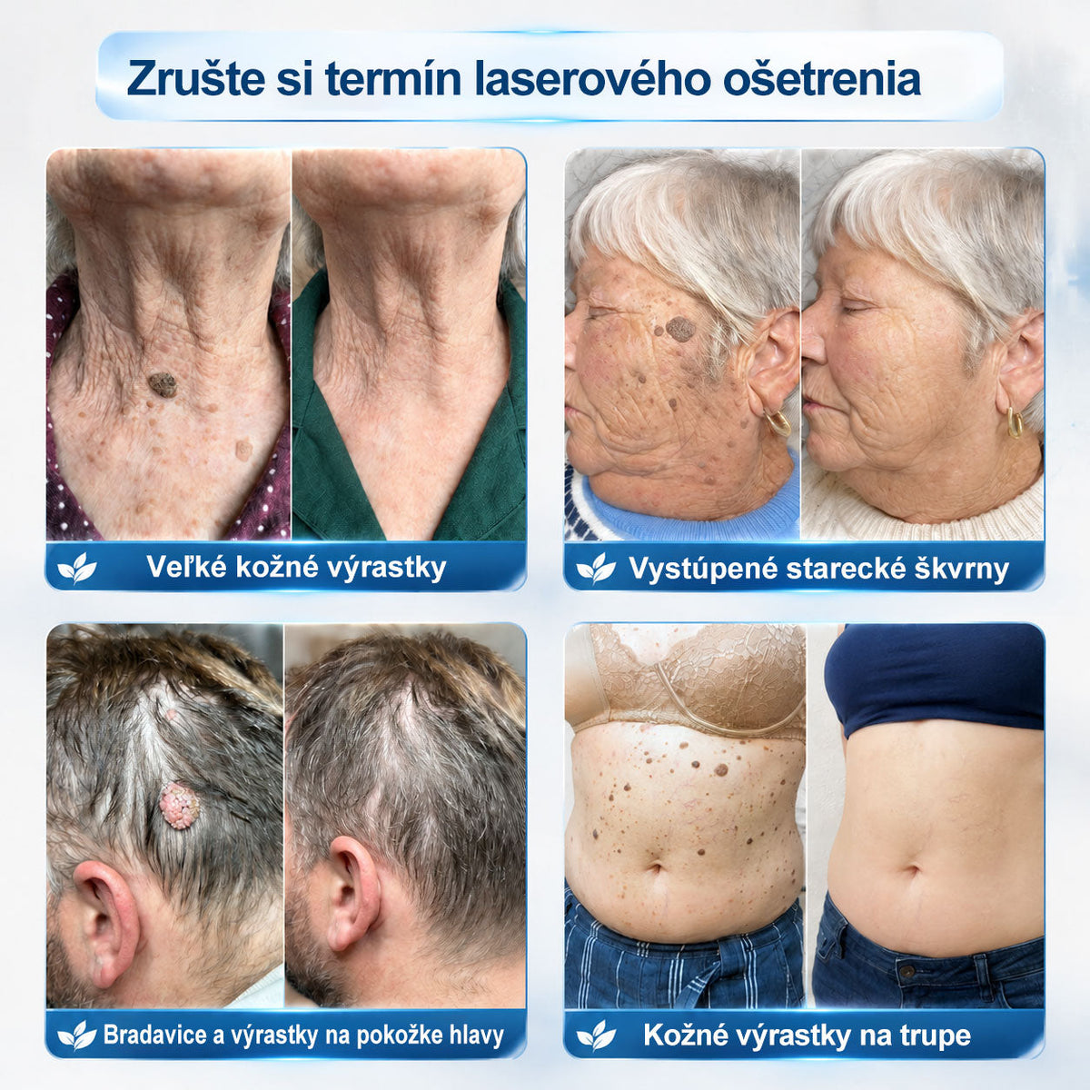 𝑶𝒇𝒊𝒄𝒊á𝒍𝒏𝒚 𝒐𝒃𝒄𝒉𝒐𝒅 ✅️ | 𝑷𝐢𝐜𝑑𝑜® 7-𝒅ň𝒐𝒗ý 𝒑𝒓í𝒑𝒓𝒂𝒗𝒐𝒌 𝒏𝒂 𝒐𝒅𝒔𝒕𝒓á𝒏𝒆𝒏𝒊𝒆 𝒌𝒐ž𝒏ý𝒄𝒉 𝒗ý𝒓𝒂𝒔𝒕𝒌𝒐𝒗 𝒂 𝒑𝒊𝒈𝒎𝒆𝒏𝒕𝒐𝒗ý𝒄𝒉 š𝒌𝒗ŕ𝒏👩‍⚕️ (𝒃𝒆𝒛 𝒃𝒐𝒍𝒆𝒔𝒕𝒊, 𝒃𝒆𝒛 𝒋𝒂𝒛𝒊𝒆𝒗, 𝒑𝒓𝒆𝒔𝒏ý 𝒓𝒐𝒍𝒍-𝒐𝒏 𝒂𝒑𝒍𝒊𝒌á𝒕𝒐𝒓) 📦