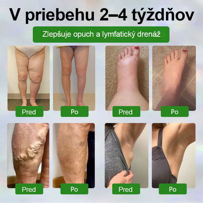 🌿🌿🌿Dorina® Bylinný krém na zmiernenie opuchov s čiernou rascou.