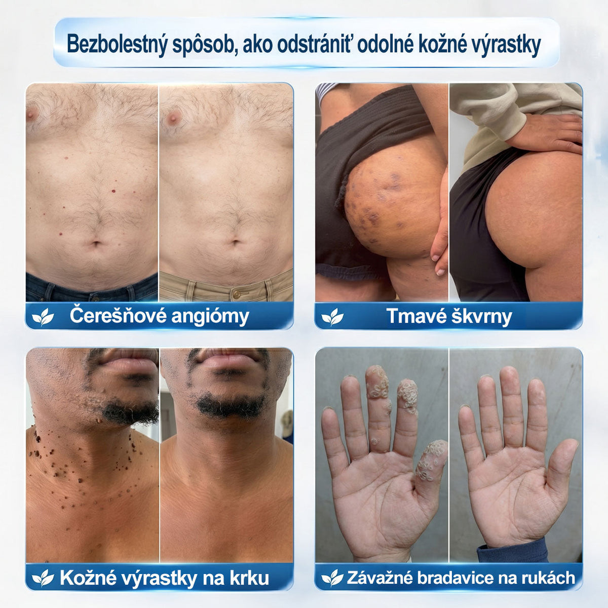 𝑶𝒇𝒊𝒄𝒊á𝒍𝒏𝒚 𝒐𝒃𝒄𝒉𝒐𝒅 ✅️ | 𝑷𝐢𝐜𝑑𝑜® 7-𝒅ň𝒐𝒗ý 𝒑𝒓í𝒑𝒓𝒂𝒗𝒐𝒌 𝒏𝒂 𝒐𝒅𝒔𝒕𝒓á𝒏𝒆𝒏𝒊𝒆 𝒌𝒐ž𝒏ý𝒄𝒉 𝒗ý𝒓𝒂𝒔𝒕𝒌𝒐𝒗 𝒂 𝒑𝒊𝒈𝒎𝒆𝒏𝒕𝒐𝒗ý𝒄𝒉 š𝒌𝒗ŕ𝒏👩‍⚕️ (𝒃𝒆𝒛 𝒃𝒐𝒍𝒆𝒔𝒕𝒊, 𝒃𝒆𝒛 𝒋𝒂𝒛𝒊𝒆𝒗, 𝒑𝒓𝒆𝒔𝒏ý 𝒓𝒐𝒍𝒍-𝒐𝒏 𝒂𝒑𝒍𝒊𝒌á𝒕𝒐𝒓) 📦