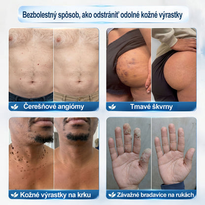 𝑶𝒇𝒊𝒄𝒊á𝒍𝒏𝒚 𝒐𝒃𝒄𝒉𝒐𝒅 ✅️ | 𝑷𝐢𝐜𝑑𝑜® 7-𝒅ň𝒐𝒗ý 𝒑𝒓í𝒑𝒓𝒂𝒗𝒐𝒌 𝒏𝒂 𝒐𝒅𝒔𝒕𝒓á𝒏𝒆𝒏𝒊𝒆 𝒌𝒐ž𝒏ý𝒄𝒉 𝒗ý𝒓𝒂𝒔𝒕𝒌𝒐𝒗 𝒂 𝒑𝒊𝒈𝒎𝒆𝒏𝒕𝒐𝒗ý𝒄𝒉 š𝒌𝒗ŕ𝒏👩‍⚕️ (𝒃𝒆𝒛 𝒃𝒐𝒍𝒆𝒔𝒕𝒊, 𝒃𝒆𝒛 𝒋𝒂𝒛𝒊𝒆𝒗, 𝒑𝒓𝒆𝒔𝒏ý 𝒓𝒐𝒍𝒍-𝒐𝒏 𝒂𝒑𝒍𝒊𝒌á𝒕𝒐𝒓) 🔥