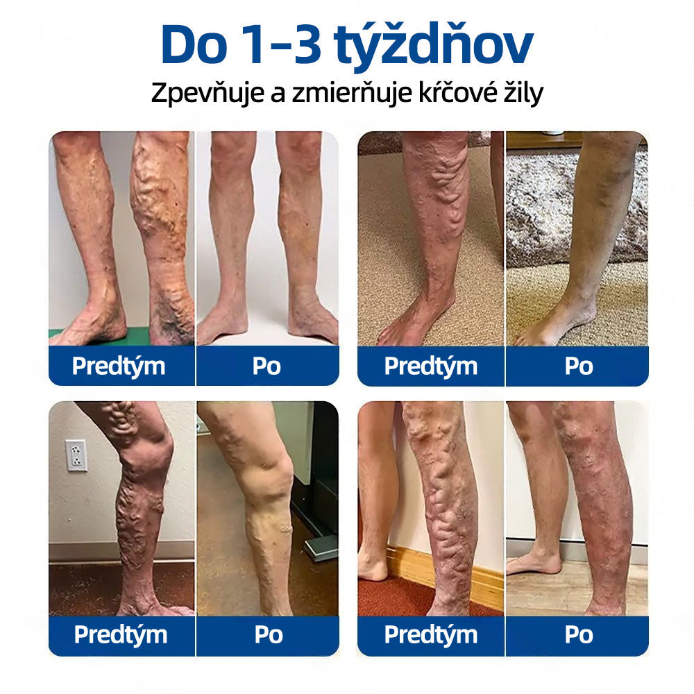 Healrize® VeinTarget mikrojihlová náplasť | Okamžitá úľava, dlhodobé výsledky