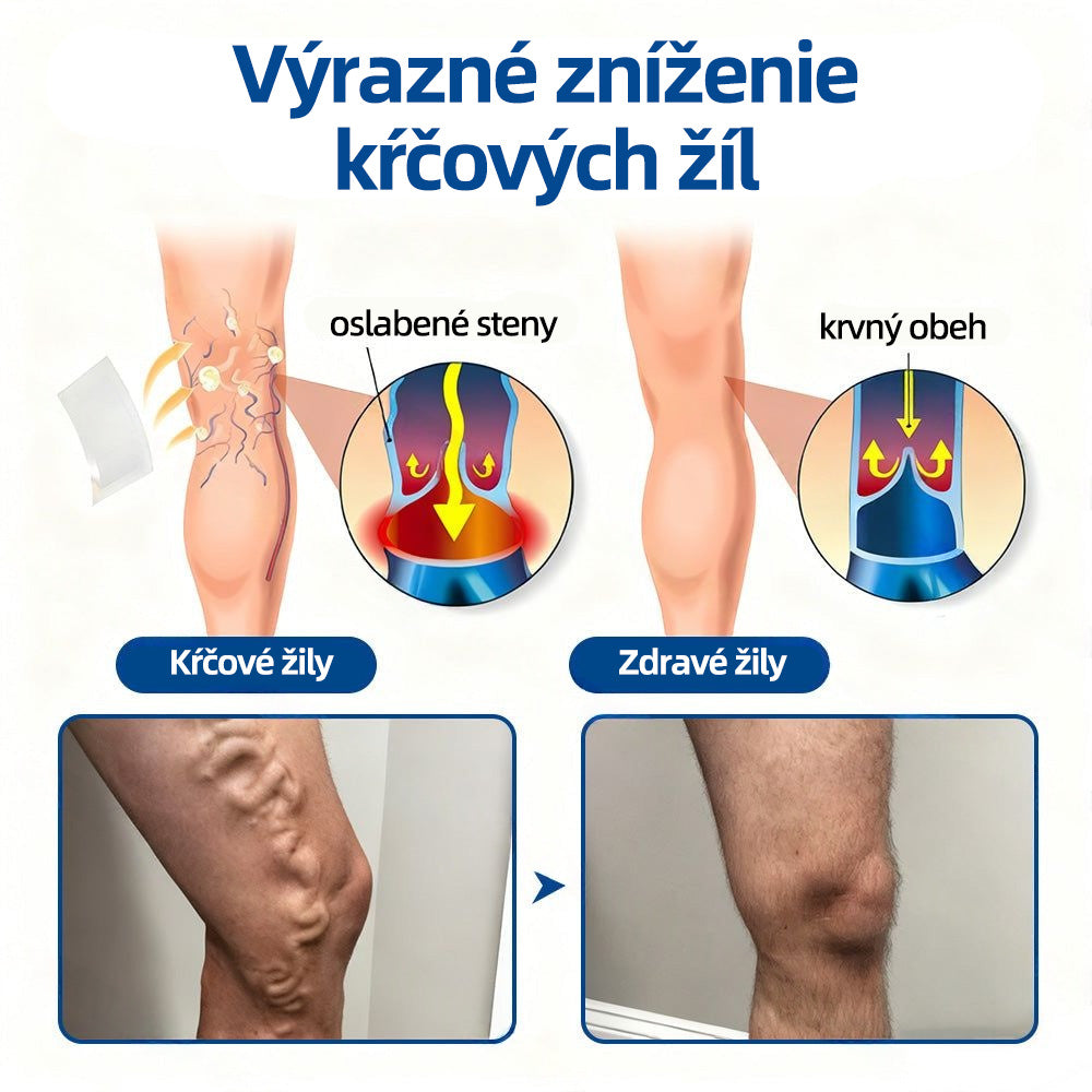 Healrize® VeinTarget mikrojihlová náplasť | Okamžitá úľava, dlhodobé výsledky