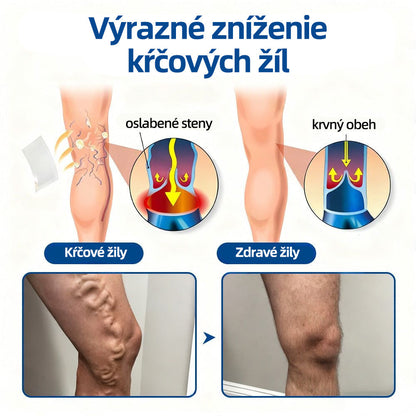 Healrize® VeinTarget mikrojihlová náplasť | Okamžitá úľava, dlhodobé výsledky