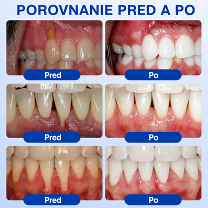 👨‍⚕️🦷 Evolvion® GumRevive – regeneračný gél na parodont🎁