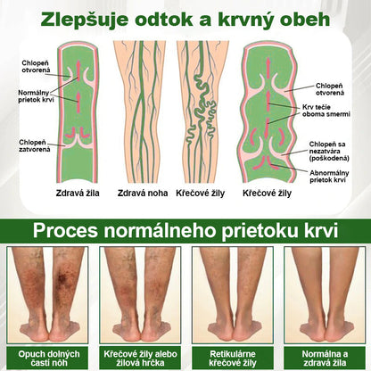 🌿🌿🌿Dorina® Bylinný krém na zmiernenie opuchov s čiernou rascou.