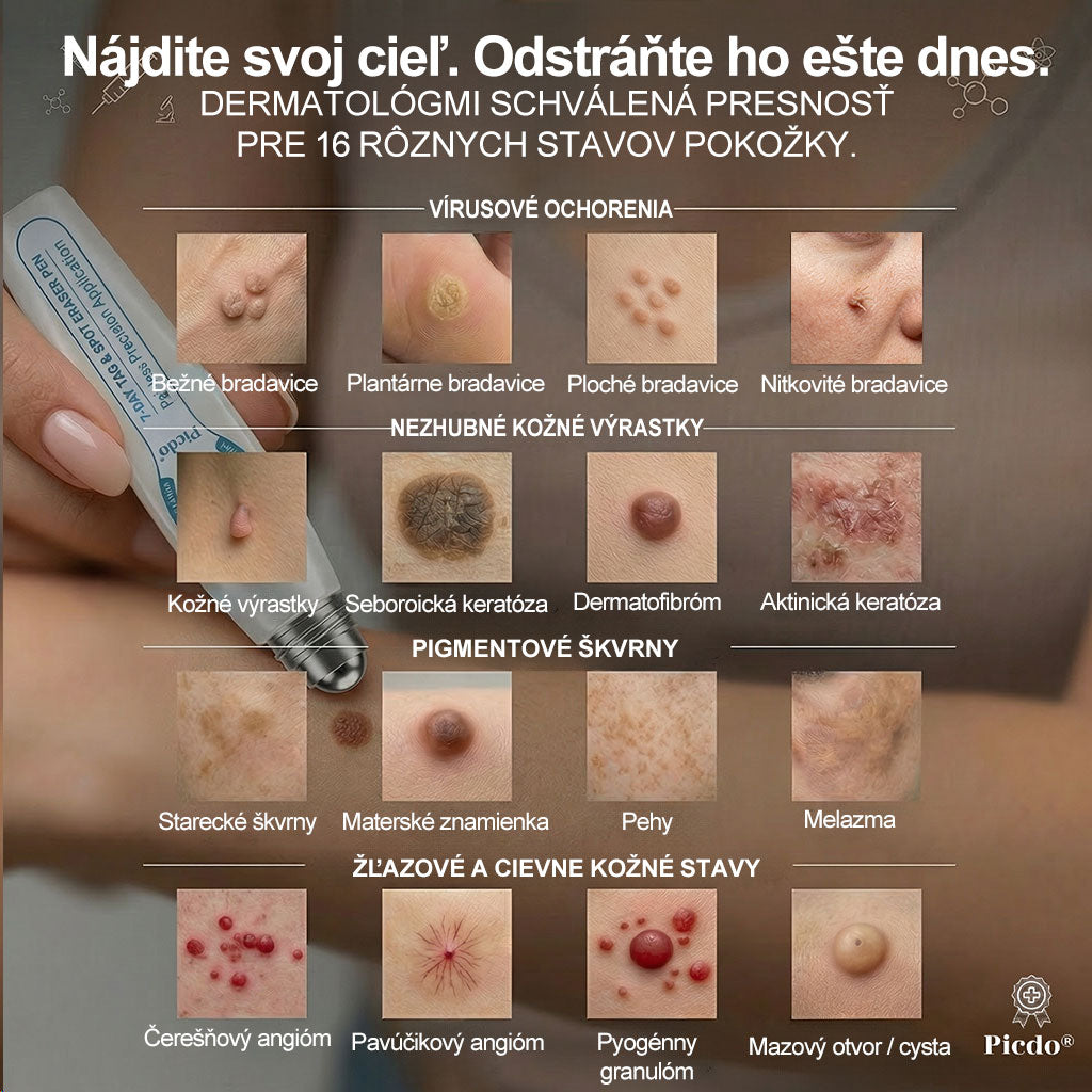 𝑶𝒇𝒊𝒄𝒊á𝒍𝒏𝒚 𝒐𝒃𝒄𝒉𝒐𝒅 ✅️ | 𝑷𝐢𝐜𝑑𝑜® 7-𝒅ň𝒐𝒗ý 𝒑𝒓í𝒑𝒓𝒂𝒗𝒐𝒌 𝒏𝒂 𝒐𝒅𝒔𝒕𝒓á𝒏𝒆𝒏𝒊𝒆 𝒌𝒐ž𝒏ý𝒄𝒉 𝒗ý𝒓𝒂𝒔𝒕𝒌𝒐𝒗 𝒂 𝒑𝒊𝒈𝒎𝒆𝒏𝒕𝒐𝒗ý𝒄𝒉 š𝒌𝒗ŕ𝒏👩‍⚕️ (𝒃𝒆𝒛 𝒃𝒐𝒍𝒆𝒔𝒕𝒊, 𝒃𝒆𝒛 𝒋𝒂𝒛𝒊𝒆𝒗, 𝒑𝒓𝒆𝒔𝒏ý 𝒓𝒐𝒍𝒍-𝒐𝒏 𝒂𝒑𝒍𝒊𝒌á𝒕𝒐𝒓) 📦