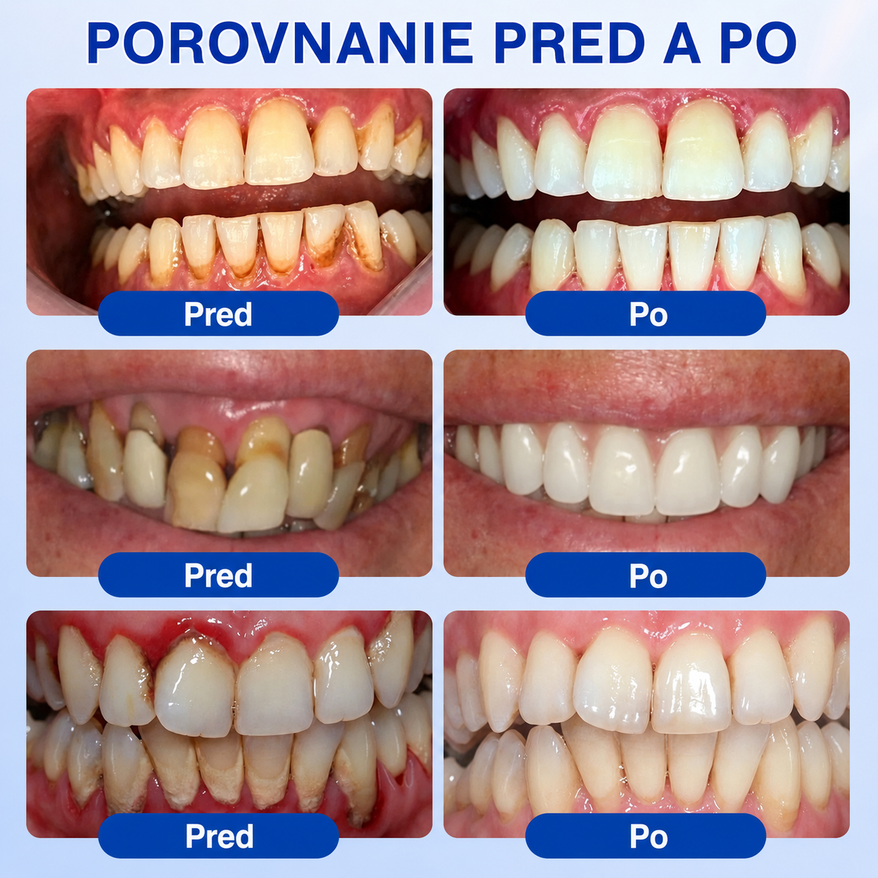👨‍⚕️🦷 Evolvion® GumRevive – regeneračný gél na parodont🎁
