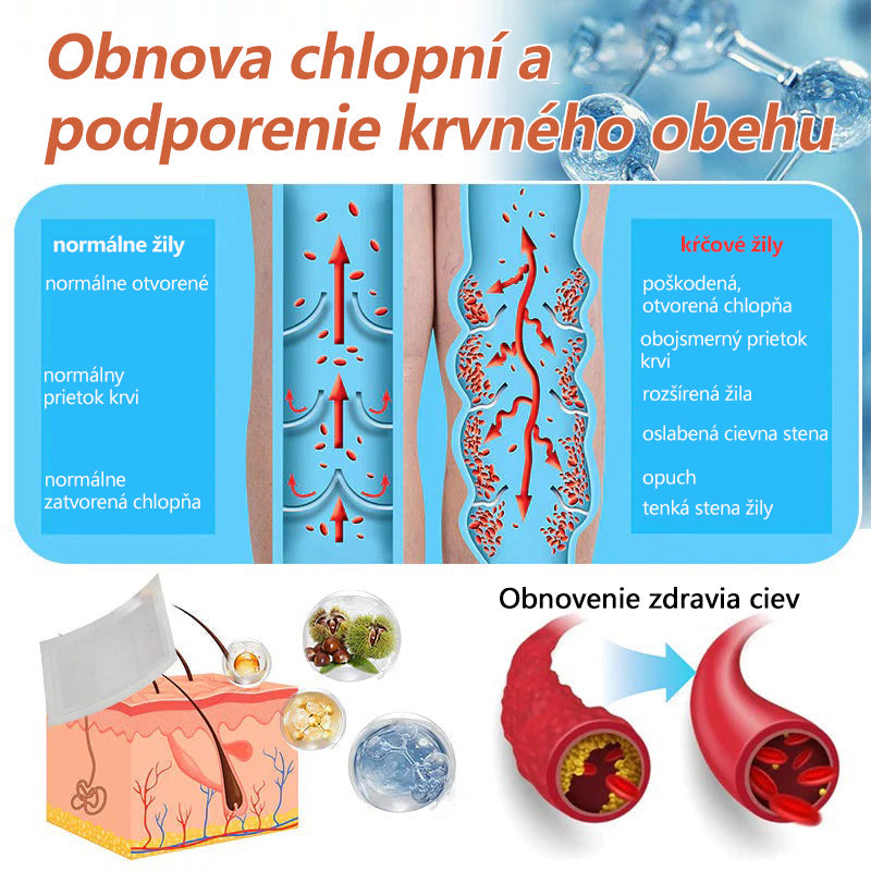 ☘️ Zvoevo® Vein Ease mikroihličková terapia (na metličkové žilky, kŕčové žily, opuchy nôh a únavu nôh)🎁
