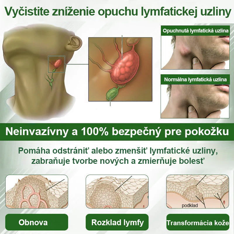 🌿🌿🌿Dorina® Bylinný krém na zmiernenie opuchov s čiernou rascou.