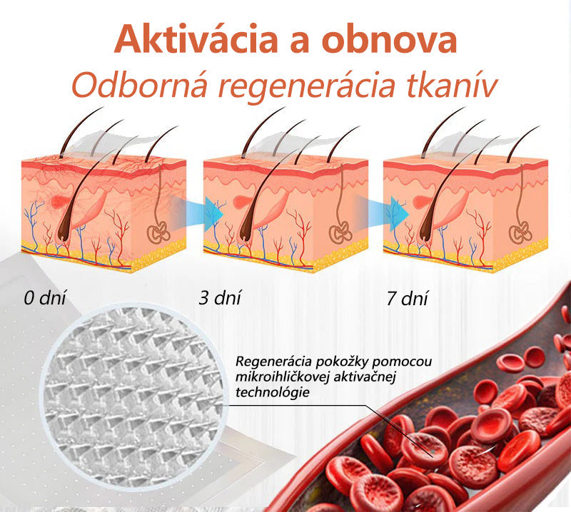 ☘️ Zvoevo® Vein Ease mikroihličková terapia (na metličkové žilky, kŕčové žily, opuchy nôh a únavu nôh)🎁
