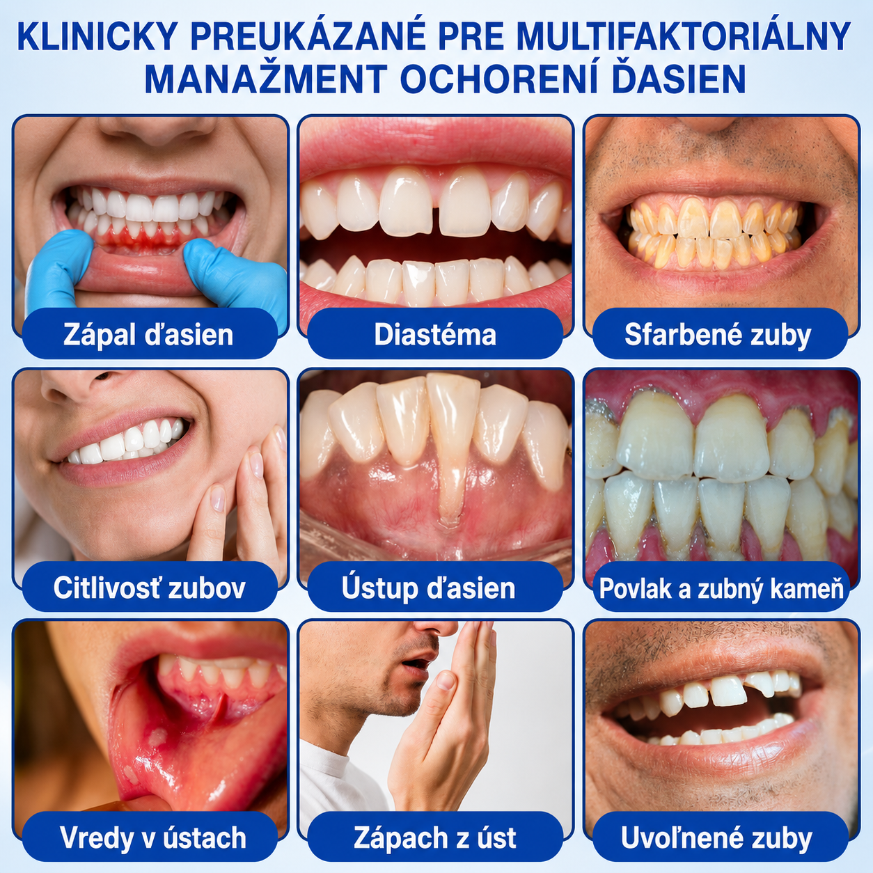 👨‍⚕️🦷 Evolvion® GumRevive – regeneračný gél na parodont🎁