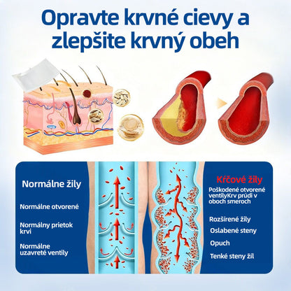 Healrize® VeinTarget mikrojihlová náplasť | Okamžitá úľava, dlhodobé výsledky